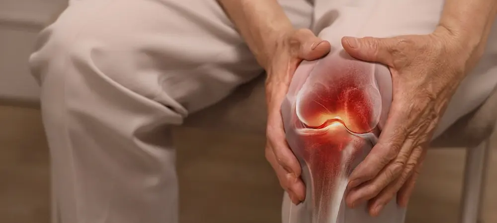 Romatoid Artrit (İltihaplı Romatizma)
